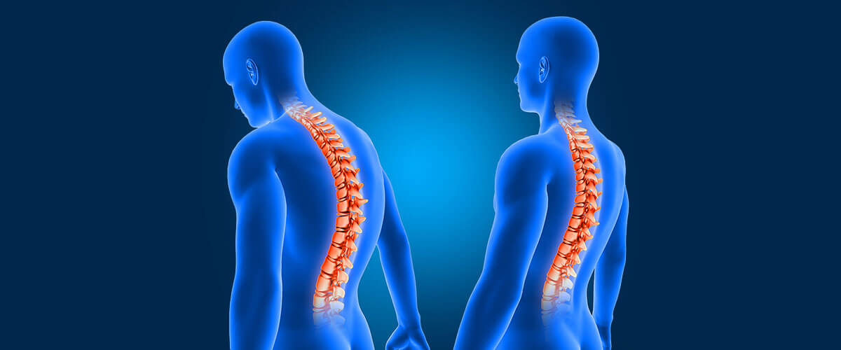 3D rendering of correct spine posture